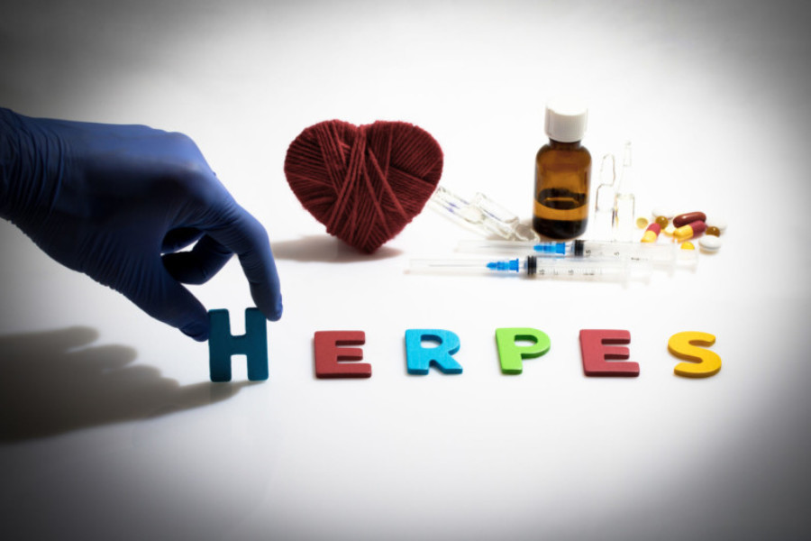 Herpes labiale: guida pratica