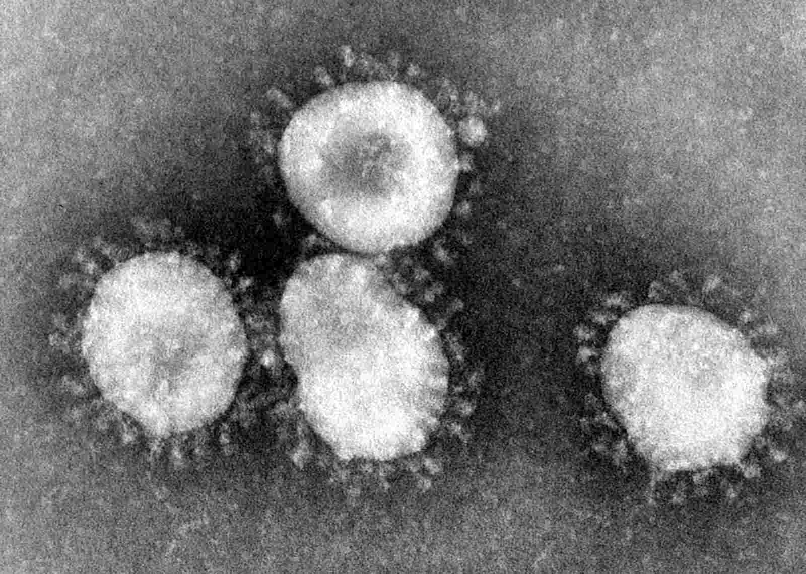 Coronavirus: domande frequenti